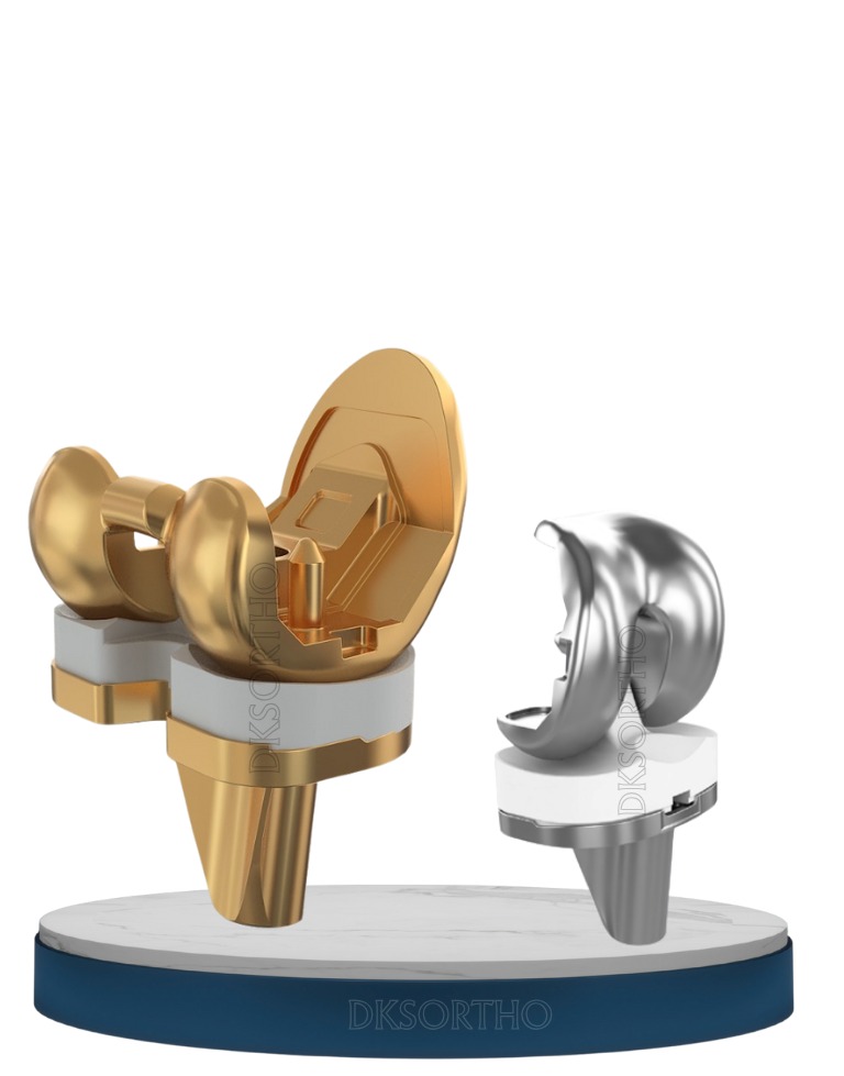 Prathmesh Knee Replacement System